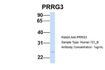 Western Blot: PRRG3 Antibody [NBP1-59992]