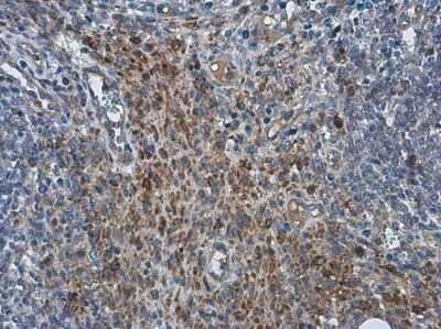 Immunohistochemistry-Paraffin: PRRSV M Protein Antibody [NBP3-12884]