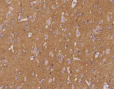 Immunohistochemistry-Paraffin: PRRT2 Antibody [NBP3-12656]