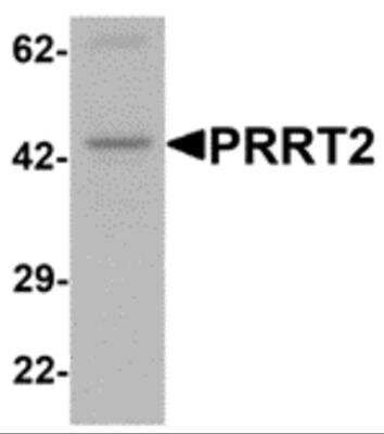 Western Blot: PRRT2 AntibodyBSA Free [NBP2-82026]