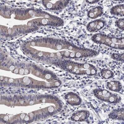 Immunohistochemistry-Paraffin: PRRT3 Antibody [NBP3-17110]