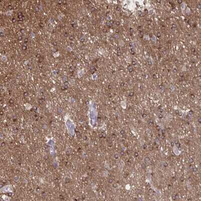 Immunohistochemistry: PRRT4 Antibody [NBP2-37936]