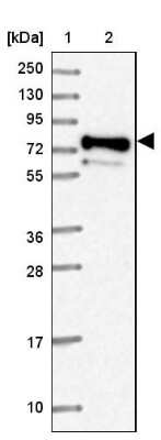 Western Blot: PRRT4 Antibody [NBP2-37917]
