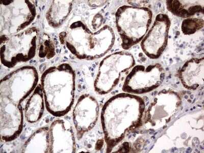 Immunohistochemistry: PRRX1 Antibody (OTI1E10) [NBP2-45407]