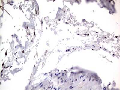 Immunohistochemistry: PRRX1 Antibody (OTI1E10) [NBP2-45407]
