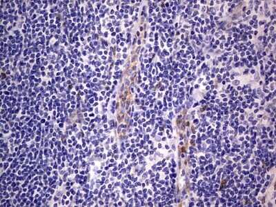 Immunohistochemistry: PRRX1 Antibody (OTI1E10) [NBP2-45407]