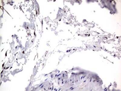 Immunohistochemistry: PRRX1 Antibody (OTI1E10) - Azide and BSA Free [NBP2-73678]