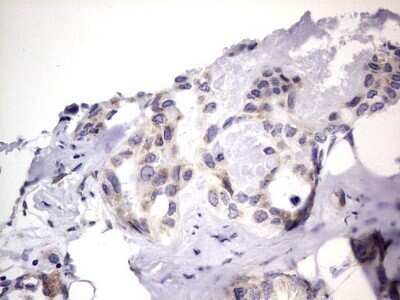 Immunohistochemistry: PRRX1 Antibody (OTI1E10) - Azide and BSA Free [NBP2-73678]