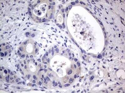Immunohistochemistry: PRRX1 Antibody (OTI1E10) - Azide and BSA Free [NBP2-73678]