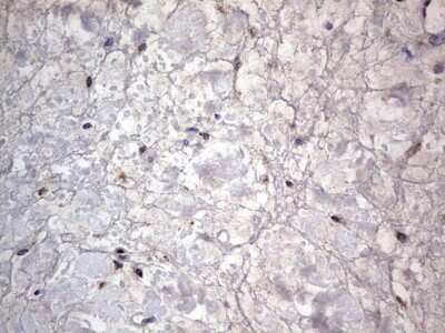 Immunohistochemistry: PRRX1 Antibody (OTI1E10) - Azide and BSA Free [NBP2-73678]