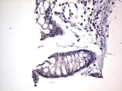 Immunohistochemistry: PRRX1 Antibody (OTI1E10) - Azide and BSA Free [NBP2-73678]