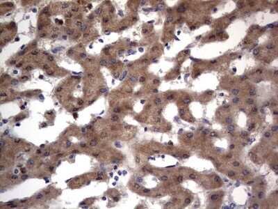 Immunohistochemistry: PRRX1 Antibody (OTI1E10) - Azide and BSA Free [NBP2-73678]