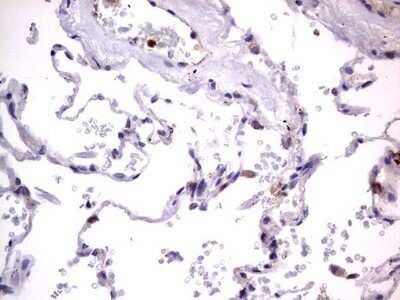 Immunohistochemistry: PRRX1 Antibody (OTI1E10) - Azide and BSA Free [NBP2-73678]