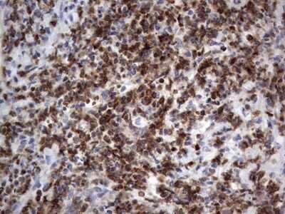 Immunohistochemistry: PRRX1 Antibody (OTI1E10) - Azide and BSA Free [NBP2-73678]