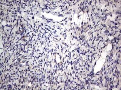 Immunohistochemistry: PRRX1 Antibody (OTI1E10) - Azide and BSA Free [NBP2-73678]