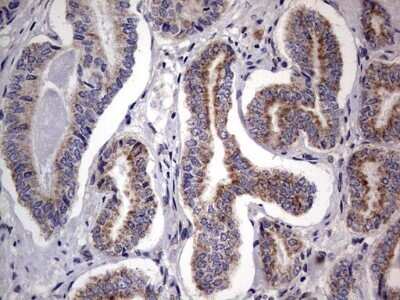 Immunohistochemistry: PRRX1 Antibody (OTI1E10) - Azide and BSA Free [NBP2-73678]