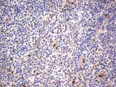 Immunohistochemistry: PRRX1 Antibody (OTI1E10) - Azide and BSA Free [NBP2-73678]