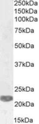 Western Blot: PRRX1 Antibody [NBP1-06067]