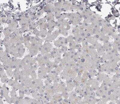 Immunohistochemistry-Paraffin: PRRX2 Antibody [NBP1-80893]