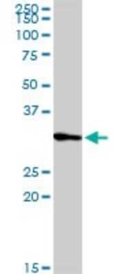 Western Blot: PRRX2 Antibody [H00051450-D01P]