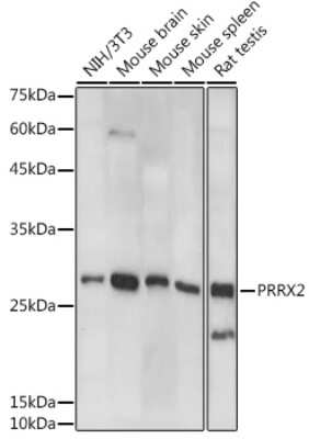 Western Blot: PRRX2 AntibodyAzide and BSA Free [NBP3-16048]