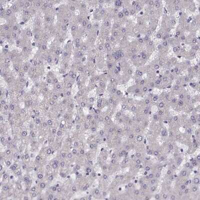 Immunohistochemistry-Paraffin: PRSS37 Antibody [NBP1-86430]