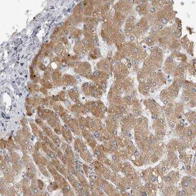 Immunohistochemistry: PRSS38 Antibody [NBP1-93453]