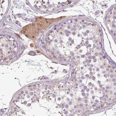 Immunohistochemistry: PRSS38 Antibody [NBP2-49193]