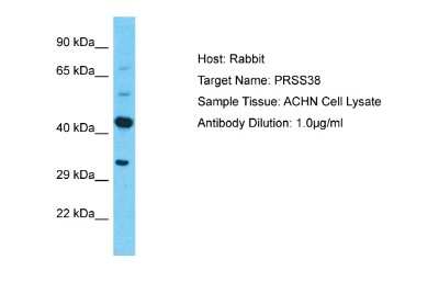 Western Blot: PRSS38 Antibody [NBP2-85547]