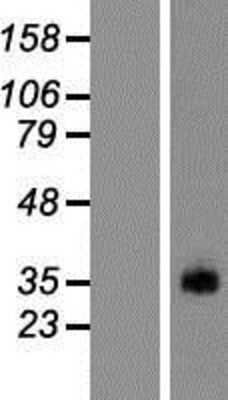 Western Blot: PRSS38 Overexpression Lysate [NBP2-04775]