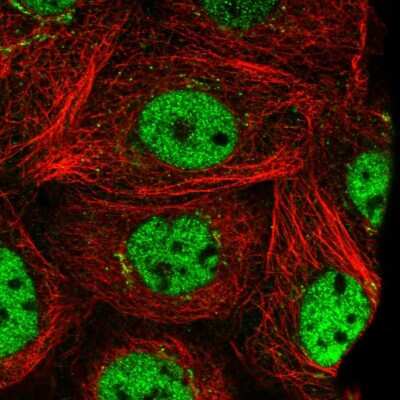 Immunocytochemistry/ Immunofluorescence: PRTFDC1 Antibody [NBP1-83261]