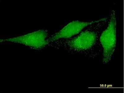 Immunocytochemistry/ Immunofluorescence: PRUNE Antibody [H00058497-B01P]