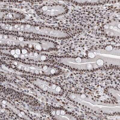 Immunohistochemistry-Paraffin: PRUNE2 Antibody [NBP1-89335]