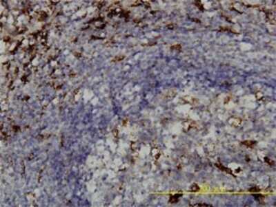 Immunohistochemistry-Paraffin: PSAP Antibody (1D1-C12) [H00005660-M01]