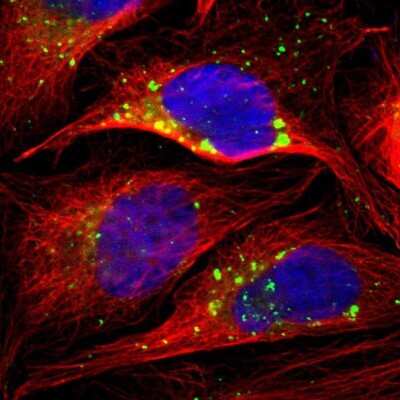 Immunocytochemistry/ Immunofluorescence: PSAP Antibody [NBP1-83363]