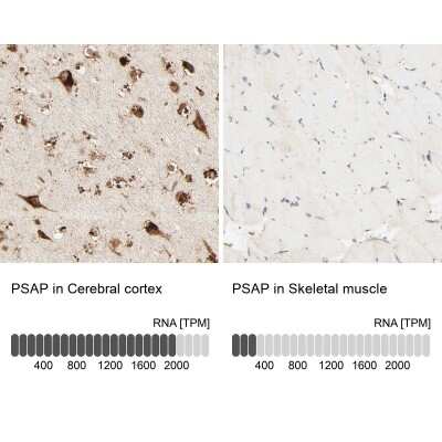 Immunohistochemistry-Paraffin: PSAP Antibody [NBP1-83363]