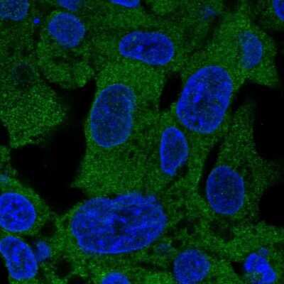 Immunocytochemistry/ Immunofluorescence: PSAT1 Antibody [NBP2-55269]