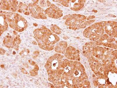 Immunohistochemistry-Paraffin: PSAT1 Antibody [NBP1-32920]