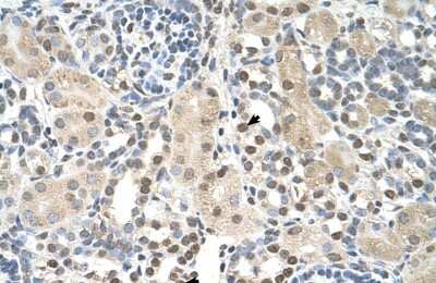 Immunohistochemistry-Paraffin: PSAT1 Antibody [NBP1-55368]