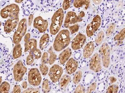 Immunohistochemistry-Paraffin: PSAT1 Antibody [NBP2-99608]