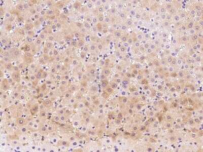 Immunohistochemistry-Paraffin: PSAT1 Antibody [NBP2-99608]