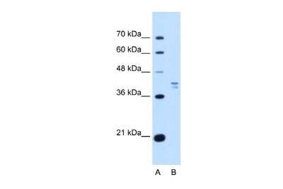 Western Blot: PSAT1 Antibody [NBP1-55368]