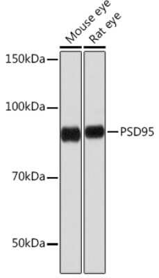Western Blot: PSD-95 Antibody (0M7N4) [NBP3-15251]
