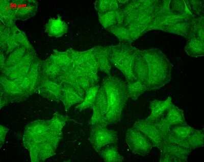 Immunocytochemistry/ Immunofluorescence: PSD-95 Antibody (7E3) [NBP2-12872]