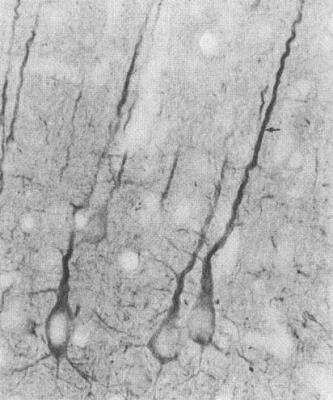 Immunohistochemistry: PSD-95 Antibody (7E3) [NBP2-12872]