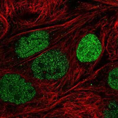 Immunocytochemistry/ Immunofluorescence: PSD3 Antibody [NBP2-55678]