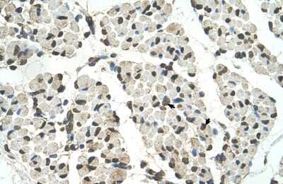 Immunohistochemistry-Paraffin: PSD3 Antibody [NBP1-55339]