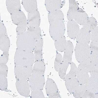 Immunohistochemistry-Paraffin: PSD4 Antibody [NBP1-84006]