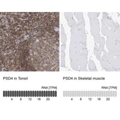 Immunohistochemistry-Paraffin: PSD4 Antibody [NBP1-84006]
