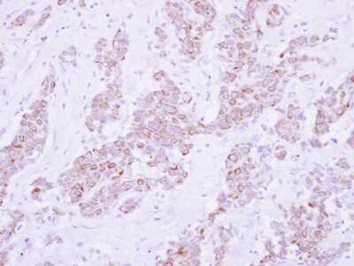 Immunohistochemistry-Paraffin: PSD4 Antibody [NBP2-19976]